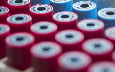 Nuovo servizio di Allergologia a Cadoneghe