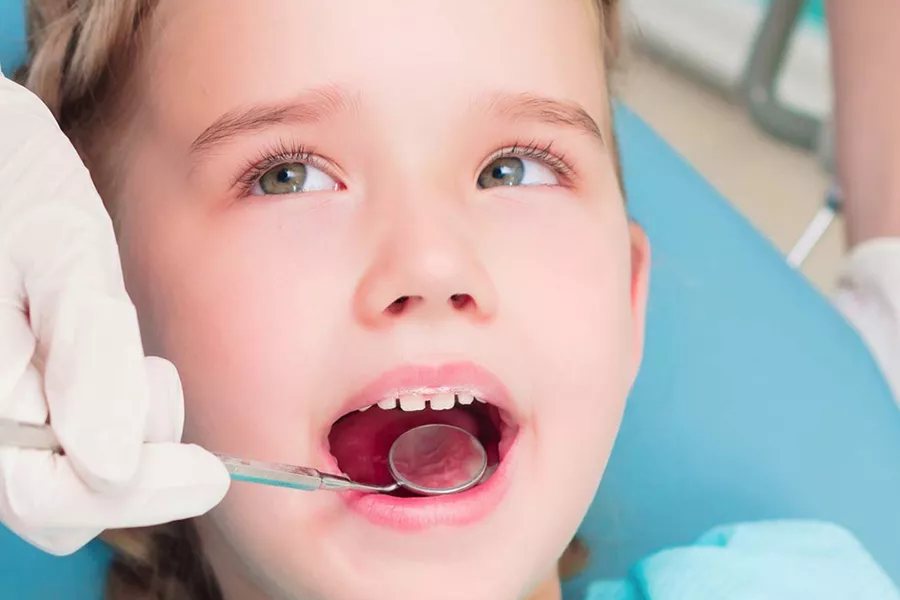 Quando i denti da latte sono neri