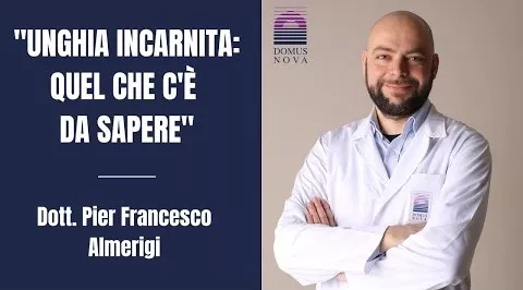 Unghia incarnita: quel che c’è da sapere
