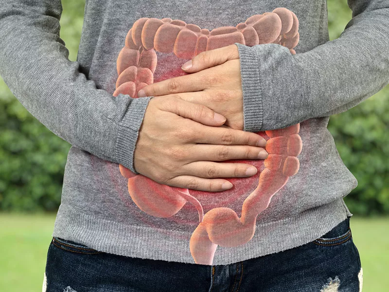 Check up intestinale