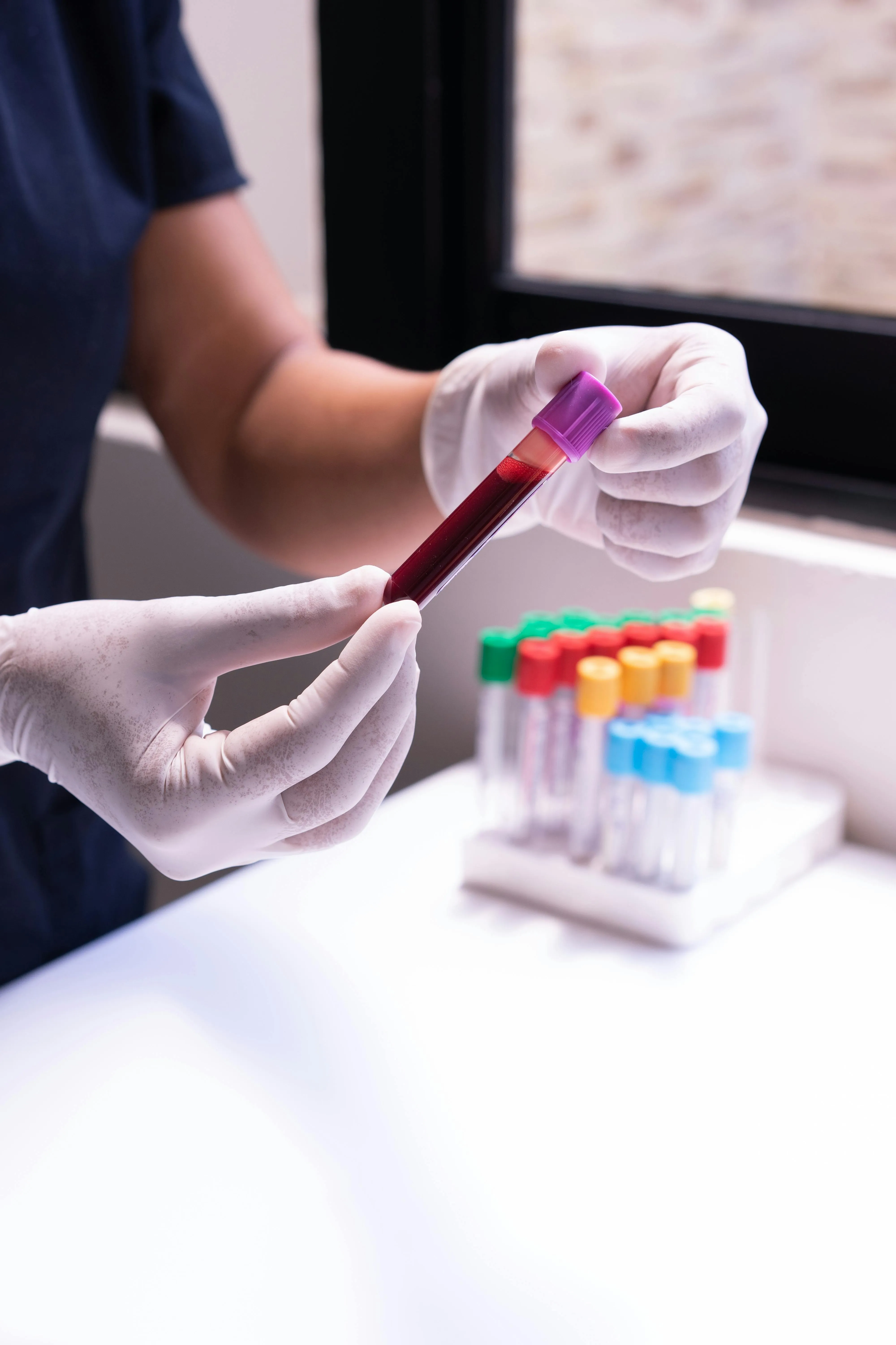Il laboratorio analisi di Aurelia Hospital effettua prelievi tutti giorni