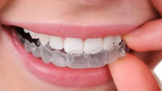 Sorridi con Arc Angel!